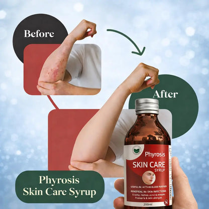 Phyrosis Skin Care & Capsule Combo – Complete Skin Wellness Pack